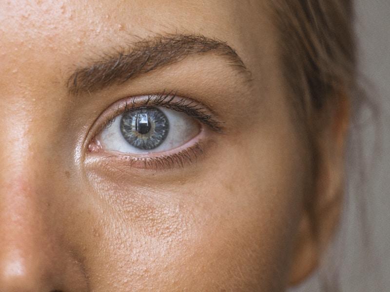 Blepharoplasty eyelid surgery cosmetic Peshawar