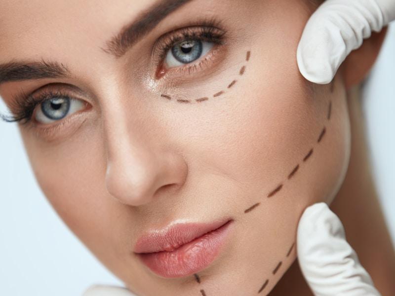 Facelift cosmetic surgery facial rejuvenation Peshawar