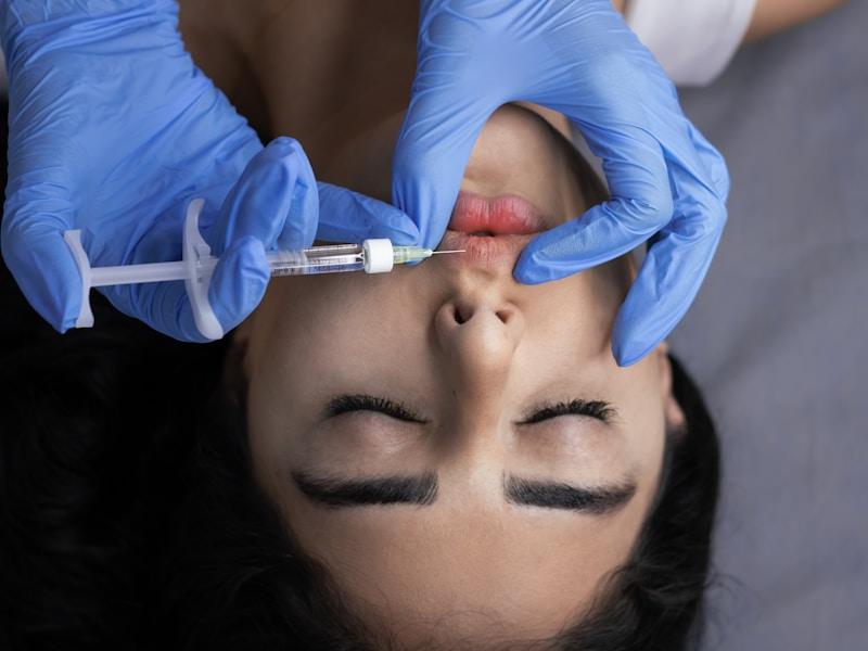 Dermal filler lip and cheek injection Peshawar
