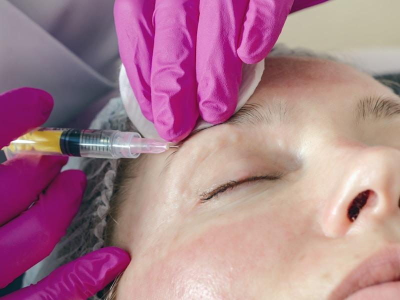 PRP PRGF platelet rich plasma facial treatment Peshawar