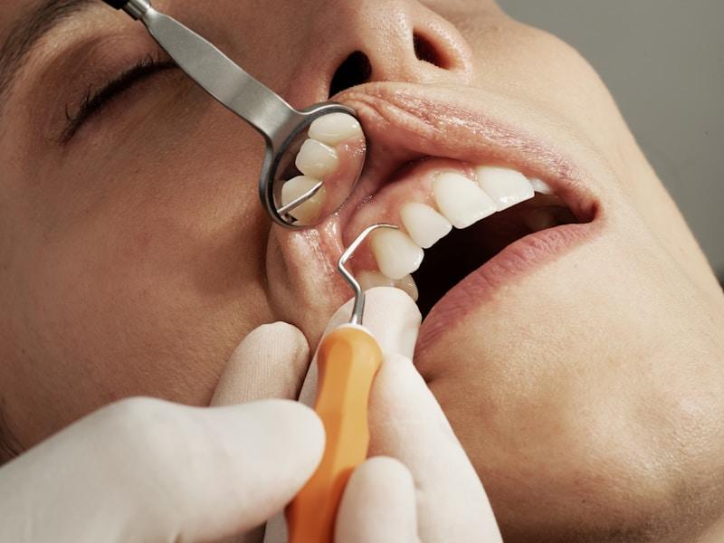 Root canal treatment dental procedure Peshawar