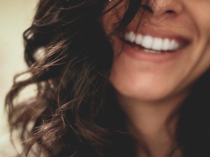 Smile makeover veneers and crowns result in Peshawar