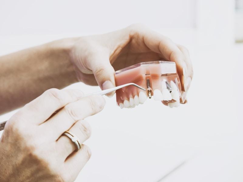 Surgical dental extraction wisdom tooth Peshawar